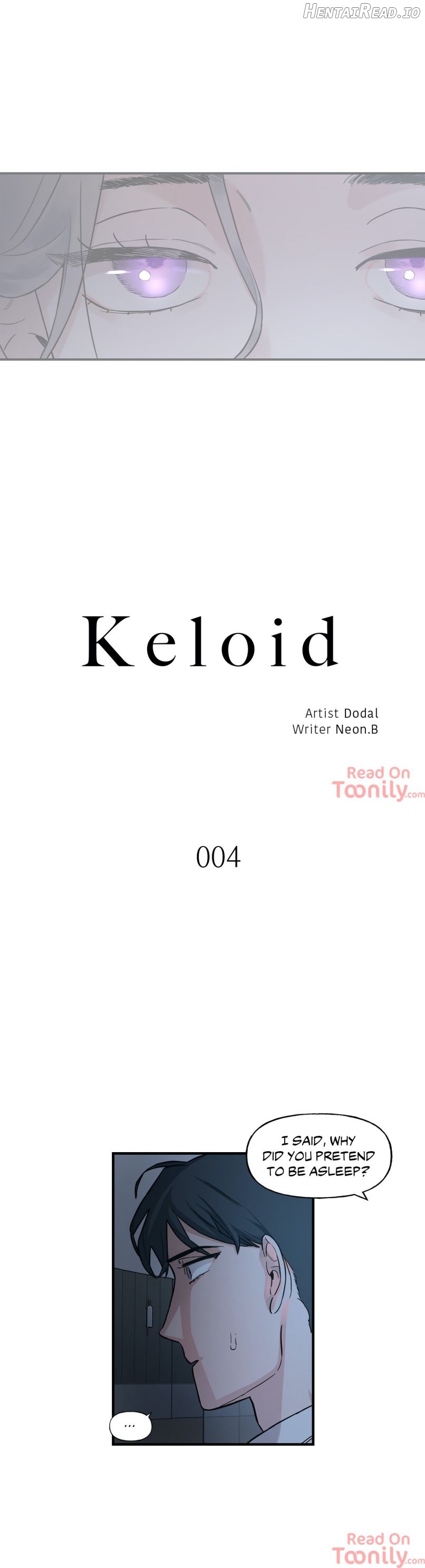 Keloid Chapter 4 - page 2